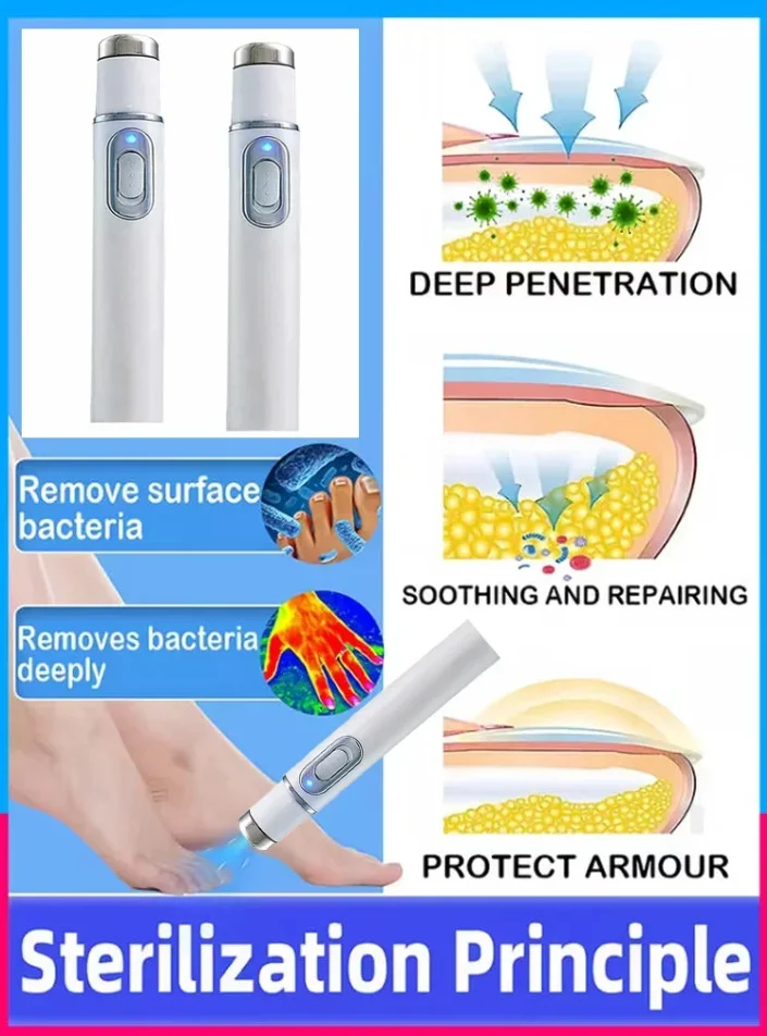 네일 수리 레이저 장비, 블루 라이트, 네일 케어 도구.