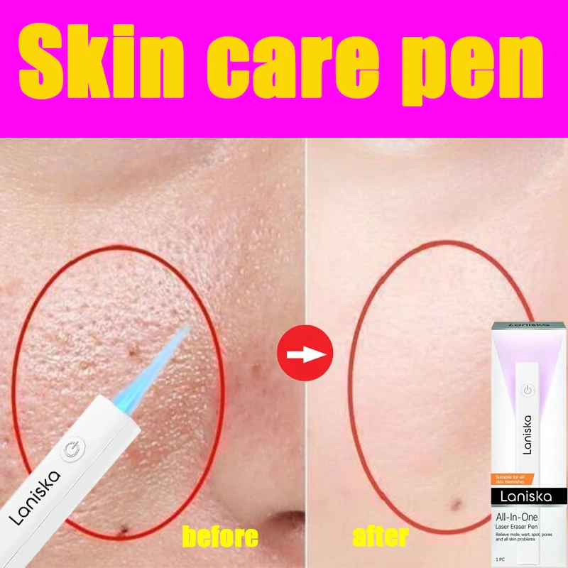 

Skin care pen gently cleanses and smoothes the skin, portable design daily care tool