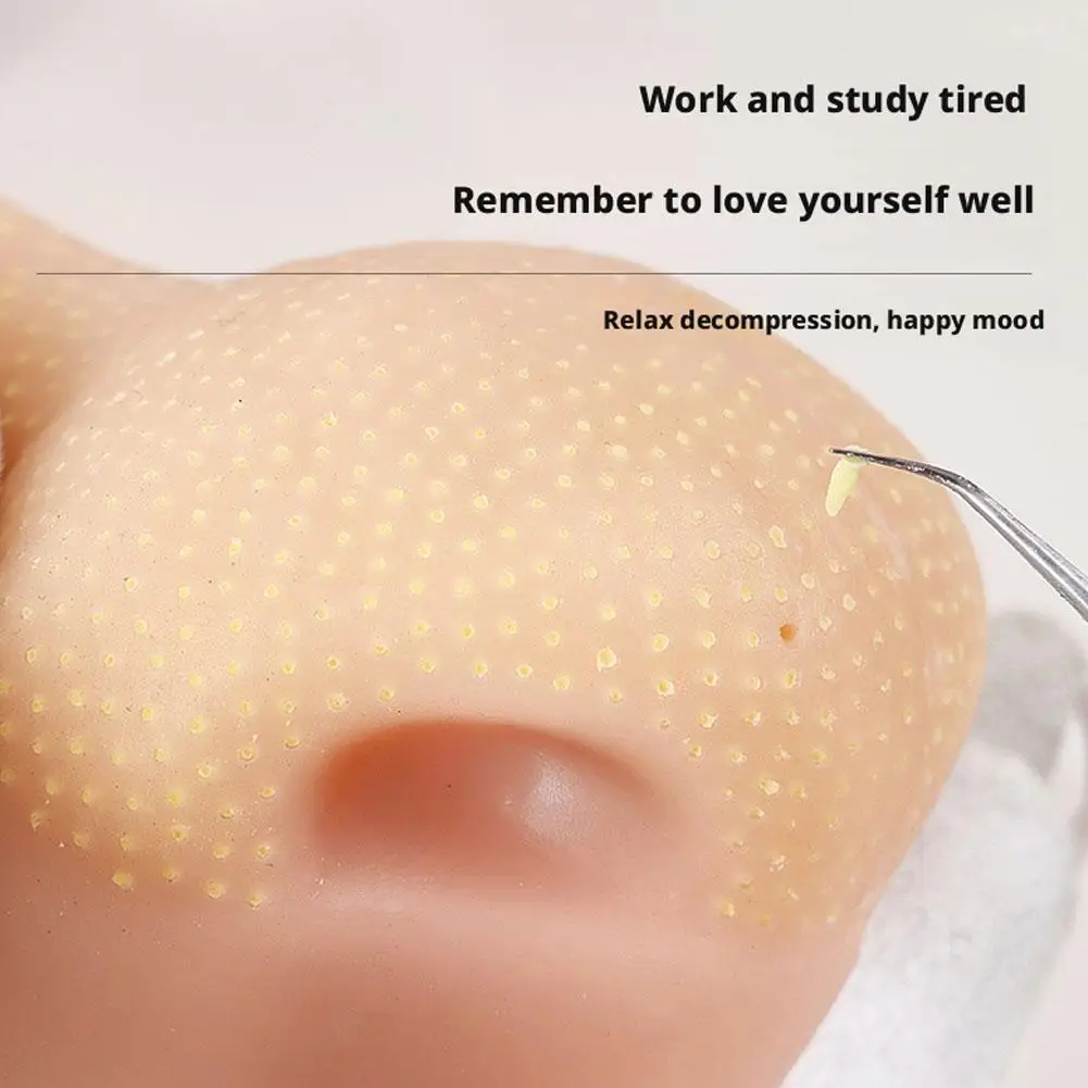 Strawberry Nose-shaped Acne Simulation Squeezing Toy Stress Relief and Anxiety Reduction Blackhead Cleaning Model.