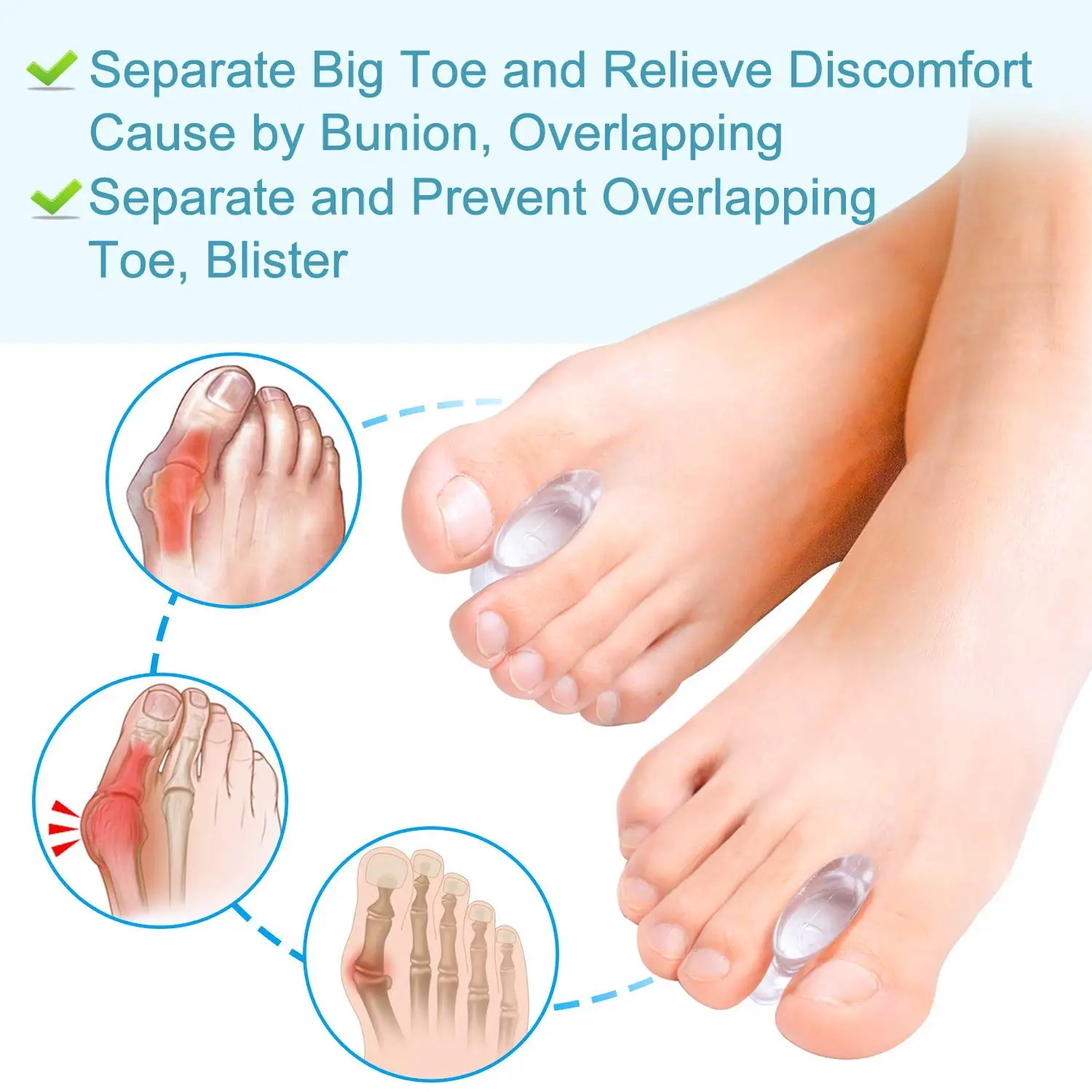 Gel Bunion Corrector and Toe Spacers Separators and Straightener Orthotics for Men and Women Overlapping Toes,Bunion Pain Relief