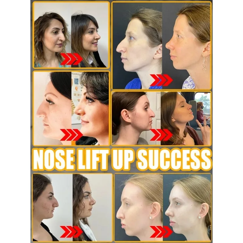 Nose Massage Essential Oil Up Heighten Rhinoplasty Firming For Moisturizing Nose Serum Reshape Natural Face Beauty Care Products