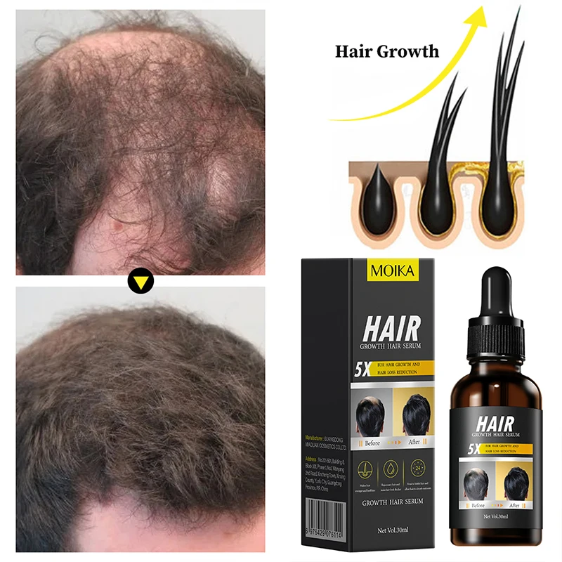1Pc MOIKA Hair Growth Serum Repair Essential Oil Beauty Hair Care Dense Regrowth Anti Hair Loss Serum Promoting Regeneration.