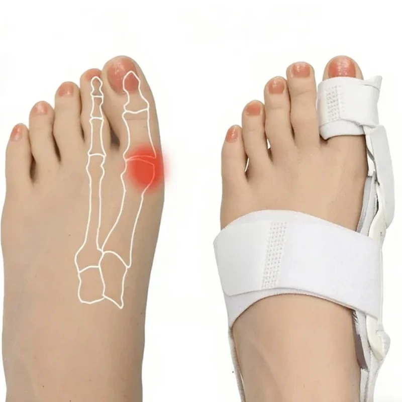 回転式調整可能足指矯正器 男女兼用 外反母趾矯正装具 左足と右足用
