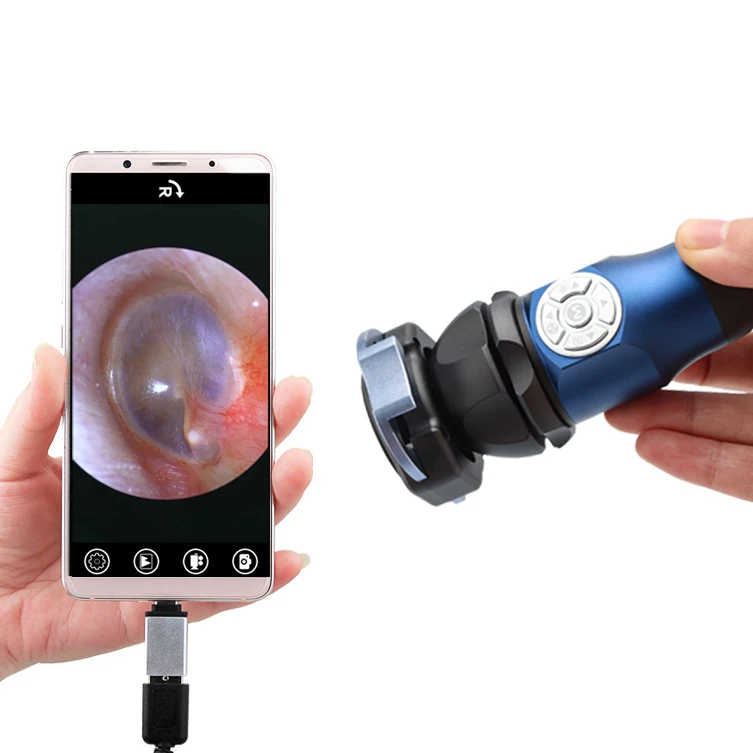 

Medical Endoscope System Ear Nose and Throat Endoscopy Portable HD 1080P USB ENT Endoscopy