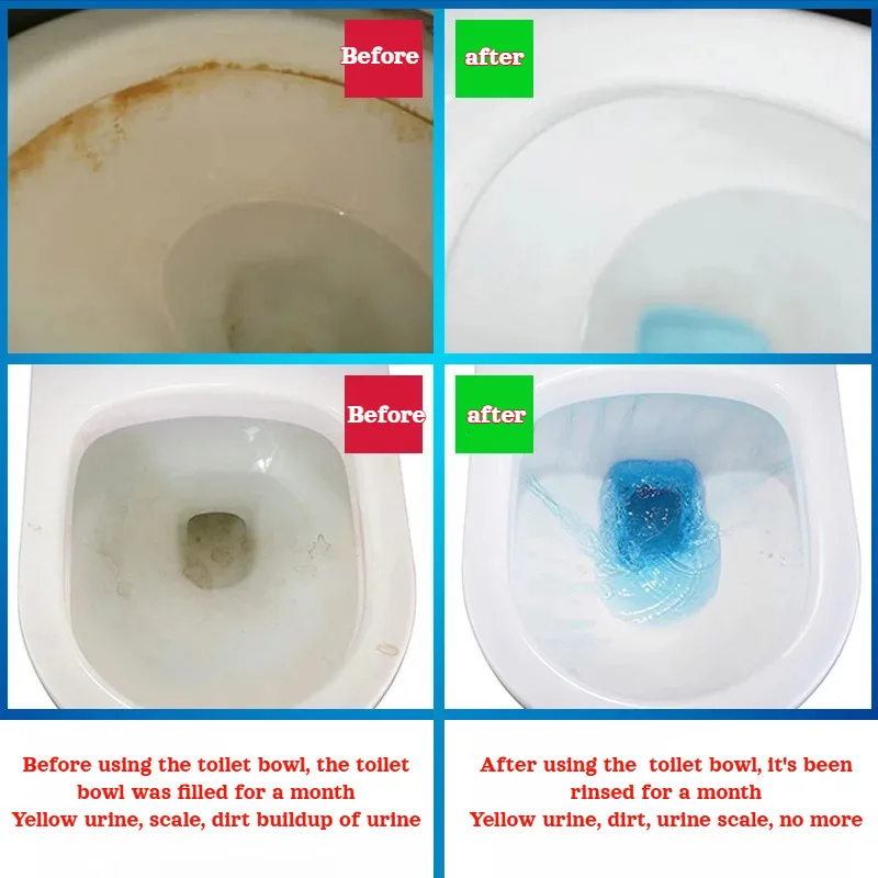 Thumbnail 2 - #13 Top 50 Toilet Bowl Cleaners Worth Buying In 2026