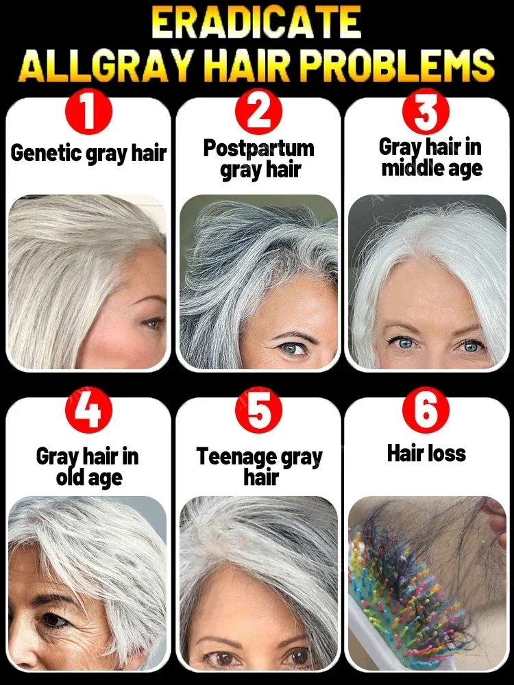 White hair, solving the problem of white hair, restoring natural hair color