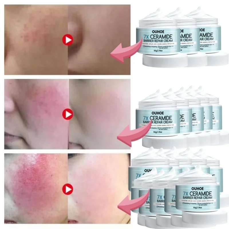 7 Day Face Rosacea Treatment Cream Collagen Intense Repair Redness Dry Sensitive Itching Skin Moisturize Sooth Korean Cosmetics