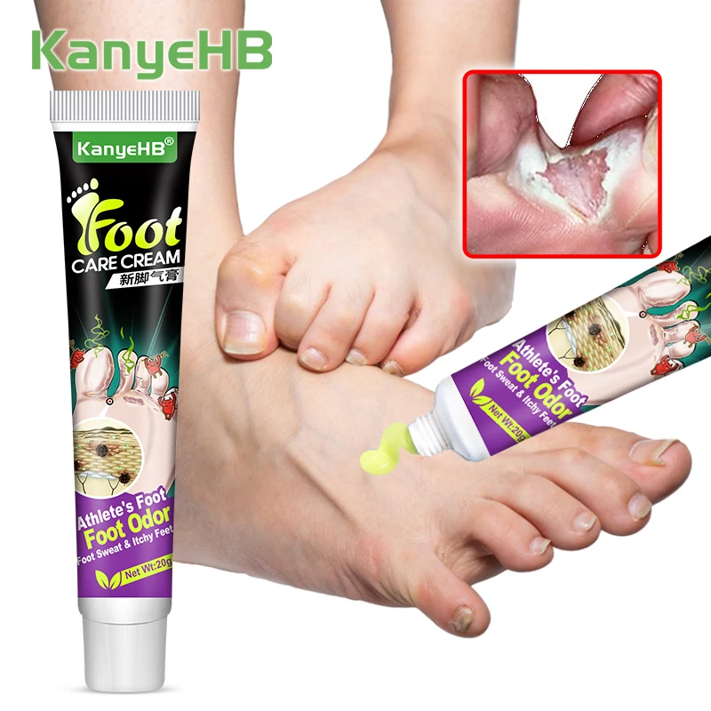 

1pcs Medical Tinea Pedis Cream Beriberi Ointment Remove Feet Odor Anti-itch Inhibit Fungi Toes Ulceration Peeling Eczema G027