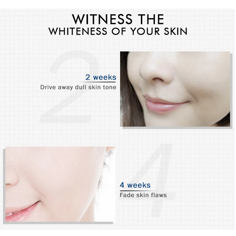 Effective Whitening Serum Remove Dark Spots Freckle Essence Anti-Aging Niacinamide Fade Pigmentation Melasma Brighten Skin Care