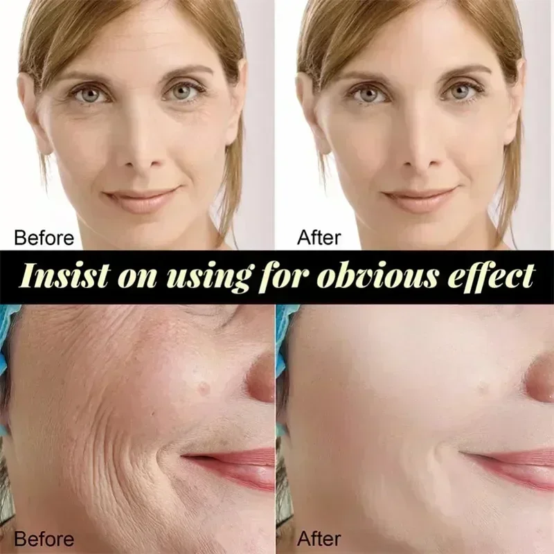 Instant Collageen Proteïne Draad Rimpel Remover Serum Set Lifting Verstevigende Oplosbare Gezichtsvuller Anti-Aging Huidverzorging