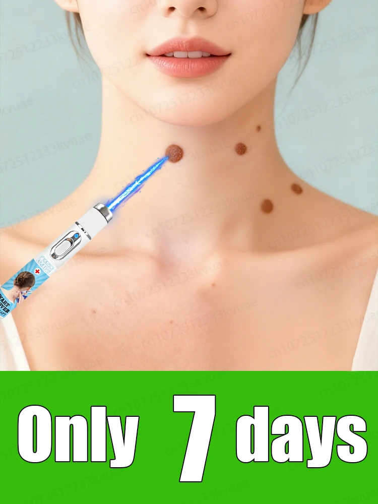 

Say goodbye to warts in 7 days, the latest upgrade, the third generation