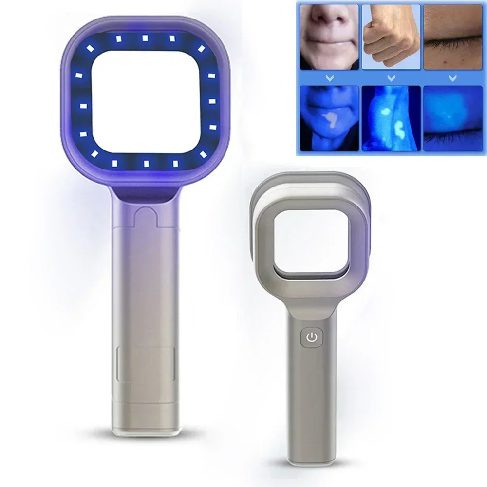 NEW Woods Lamp Skin Analyzer Portable Facial Salon Beauty Analyzer UV Lamp Wood Dermatology for Analyzing Testing Examination