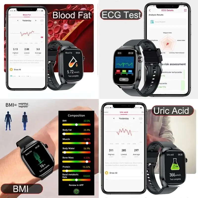 Medical Grade Health Smart Watch Men AMOLED Screen ECG Physical Examination Blood Glucose Fat Uric Acid Heart Rate Smartwatch