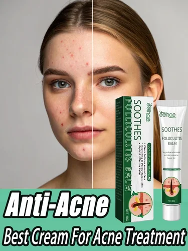 3RD crema antiacné eficaz elimina los nódulos de la piel Pustules Cysts Papulos puntos negros hombres y mujeres acné cuidado de la piel crema de esencia