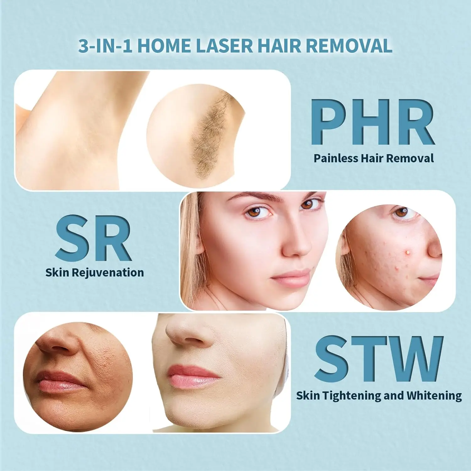 جهاز إزالة الشعر IPL للنساء والرجال، 3 في 1 غير مؤلم في الاستخدام المنزلي، تبريد الوجه، الذراعين، الساقين، خط البيكيني - هدية مثالية