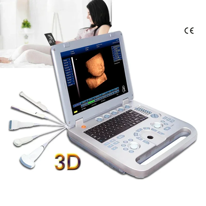 portable 3d ultrasound machine medical scan digital pseudo color usg 4d optional ecography