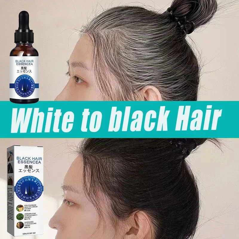 Anti-Grey cabelo soro tratamento, restaurar, impedir o cabelo, nós branco, Ahair em preto, saudável, cor natural