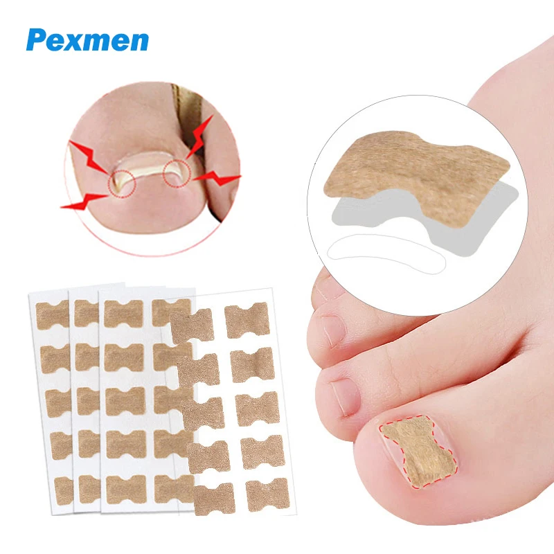 

Pexmen 10/20/50/100Pcs Ingrown Toenail Correction Sticker Foot Care Kit Ingrown Toenail Corrector Pedicure Tool Toe nail Pads