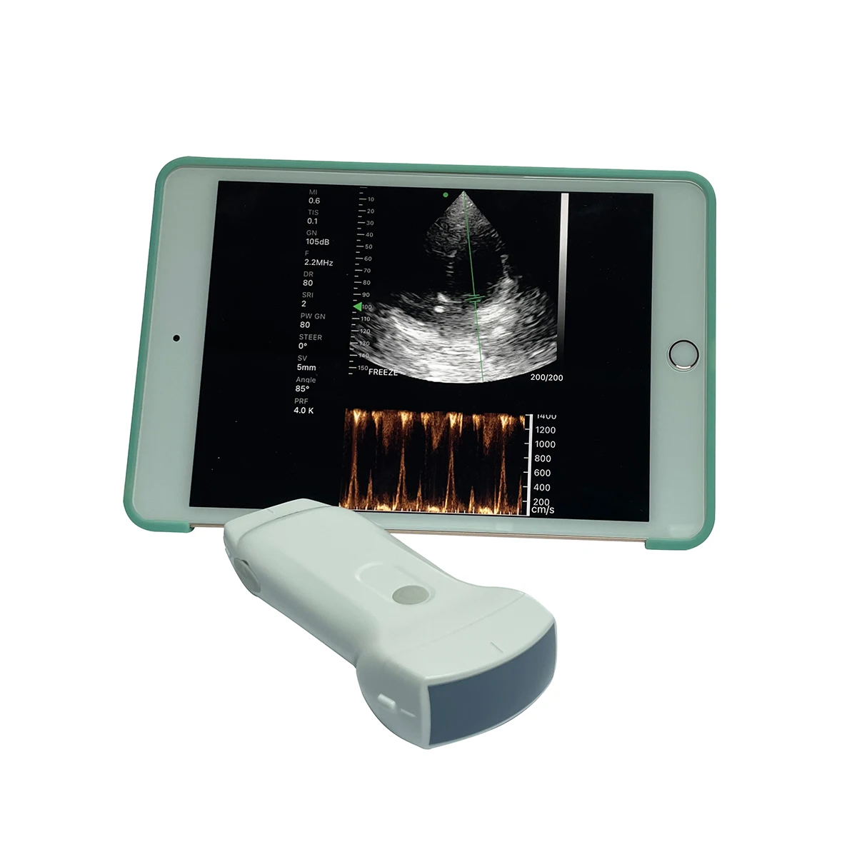 

Double Probes Wireless Color Doppler Ultrasound Scanner Wifi Ultrasound MSLPU80