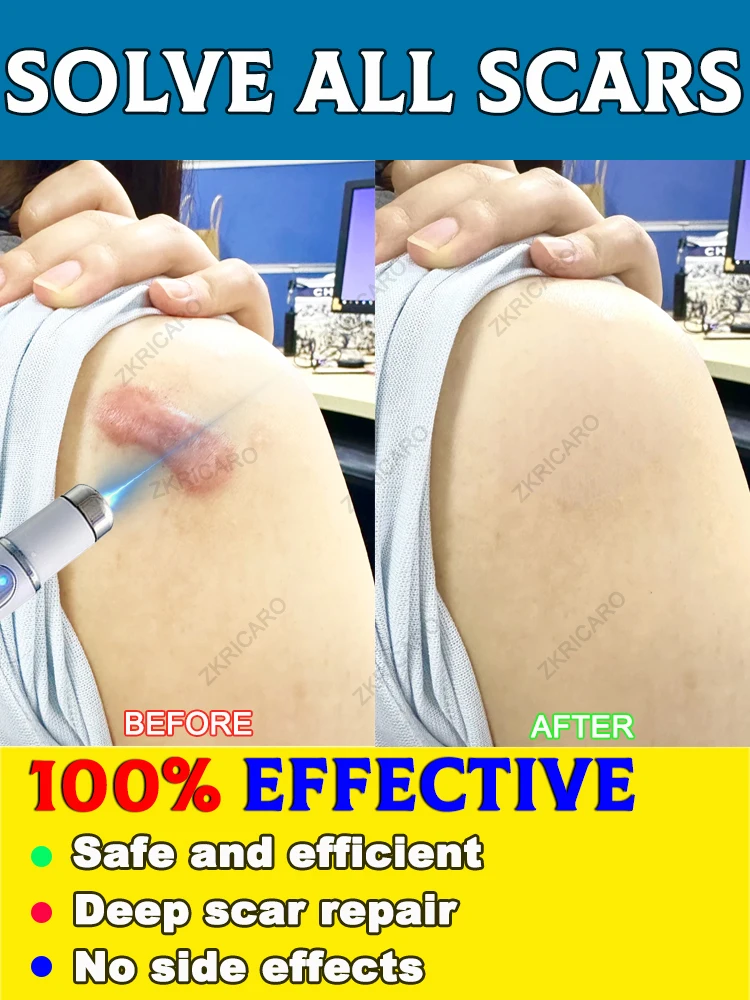 Can deeply repair various stubborn scars and solve your problems