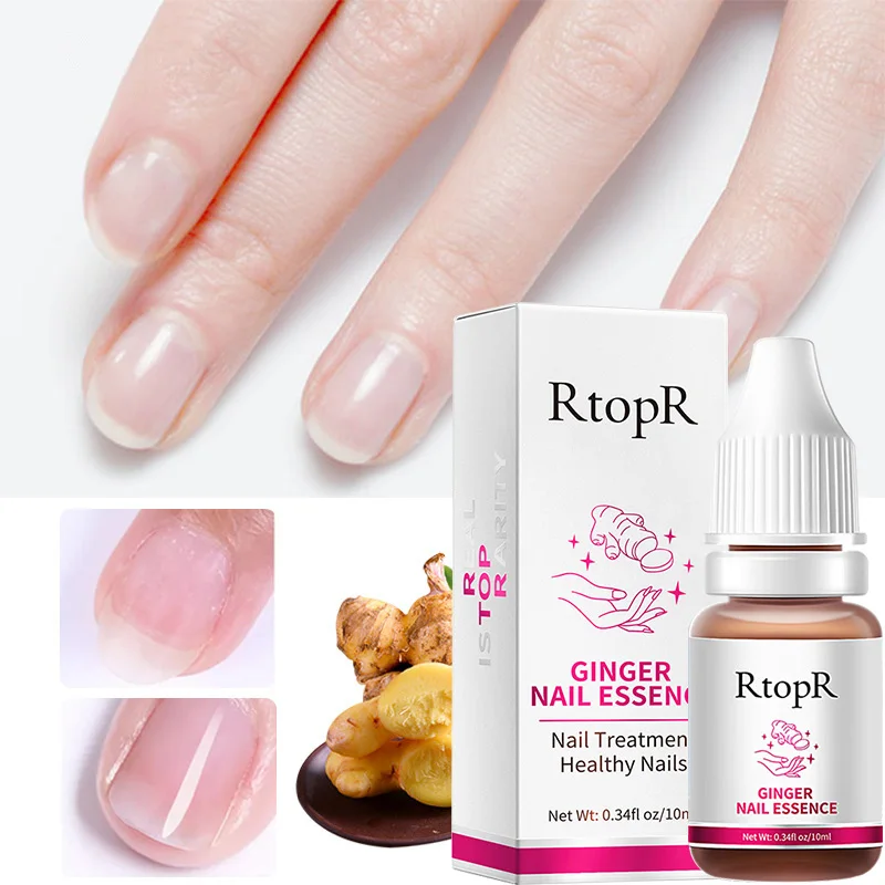 

1pc Ginger Nail Care Lotion Nourishing Alleviate Rough Nails Thicken Crack Nail Gentle Protection Of Nails Care Lotion