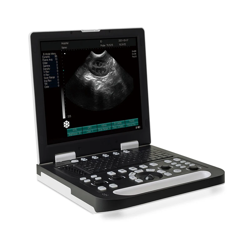 

Cheap Portable Animal Medical Equipment Ultrasound Machine Echocardiography Veterinary Ultrasound Portatil Ultrasound