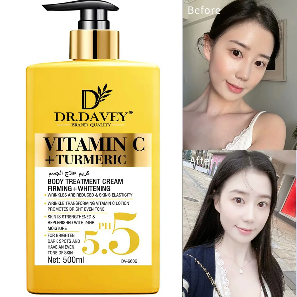 

Vitamin C+Turmeric Body Lotion Brightening Cream. Anti-aging cream for age spots, dark spots on face, hands, body. Large 500ml