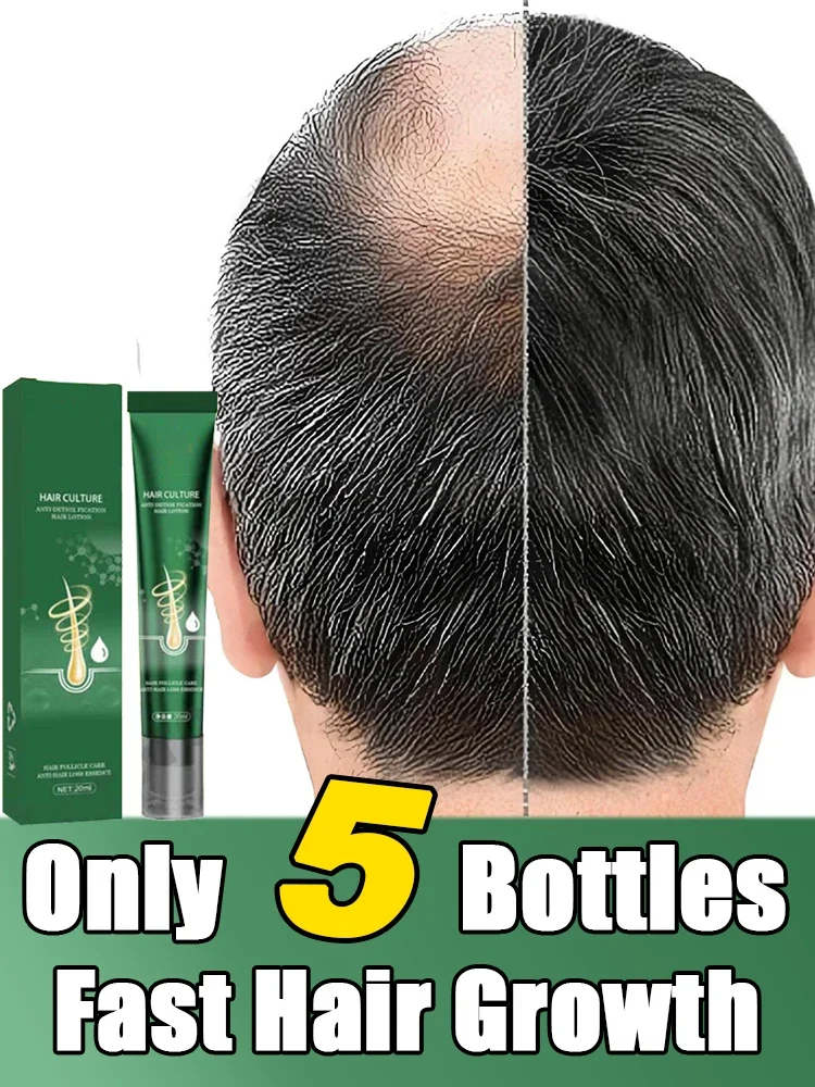 

Biotin Fast Hair Growth Oil aHair Regrowth Serum aHair Thinning Treatment aHair Growth Liquid for Women Men 2024