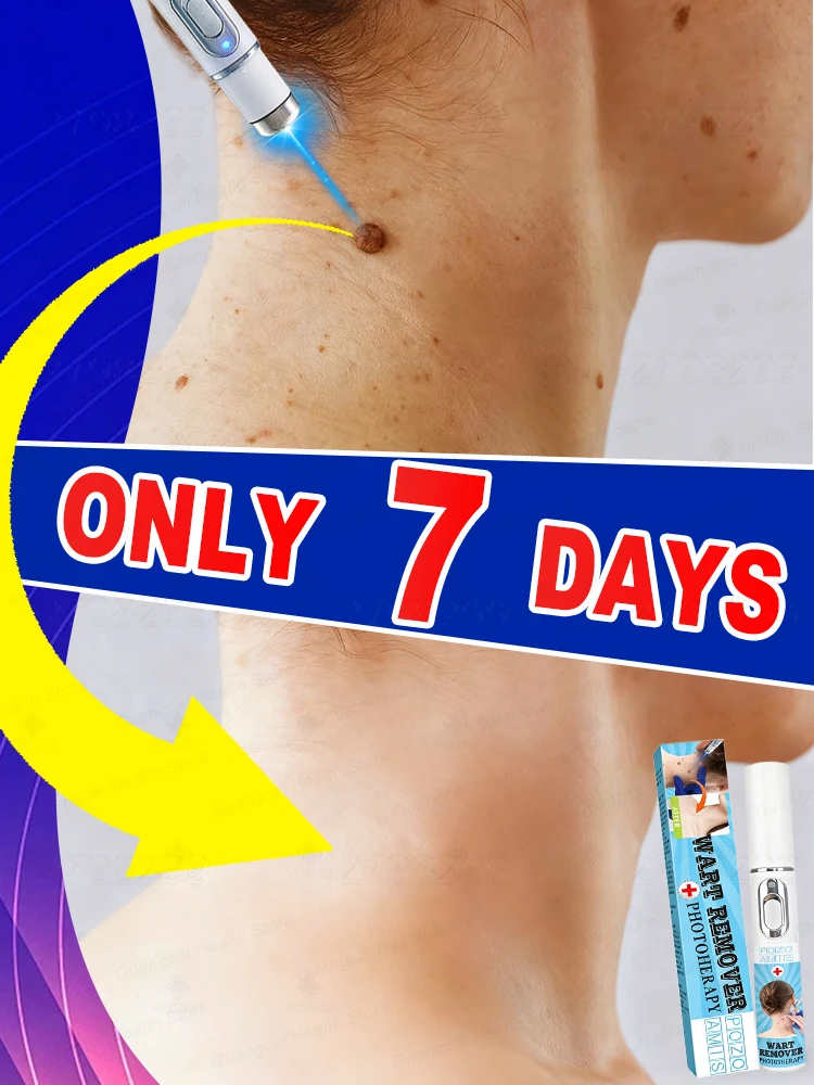 

Get rid of warts in 7 days. Solve the problem at its root.