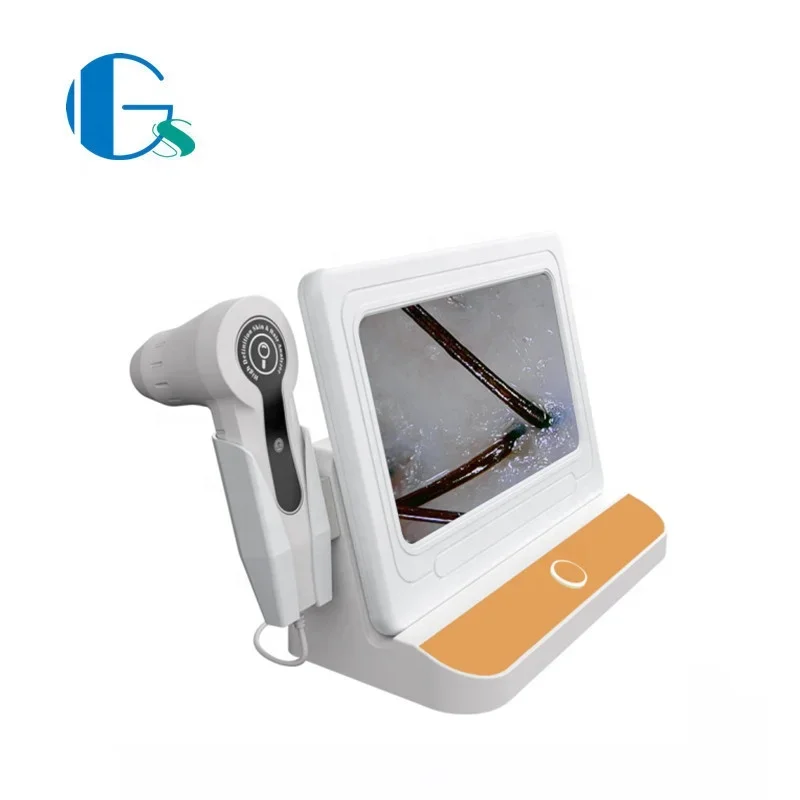 And Scalp Hair Analysis Machine hair analyzer hair scope test device