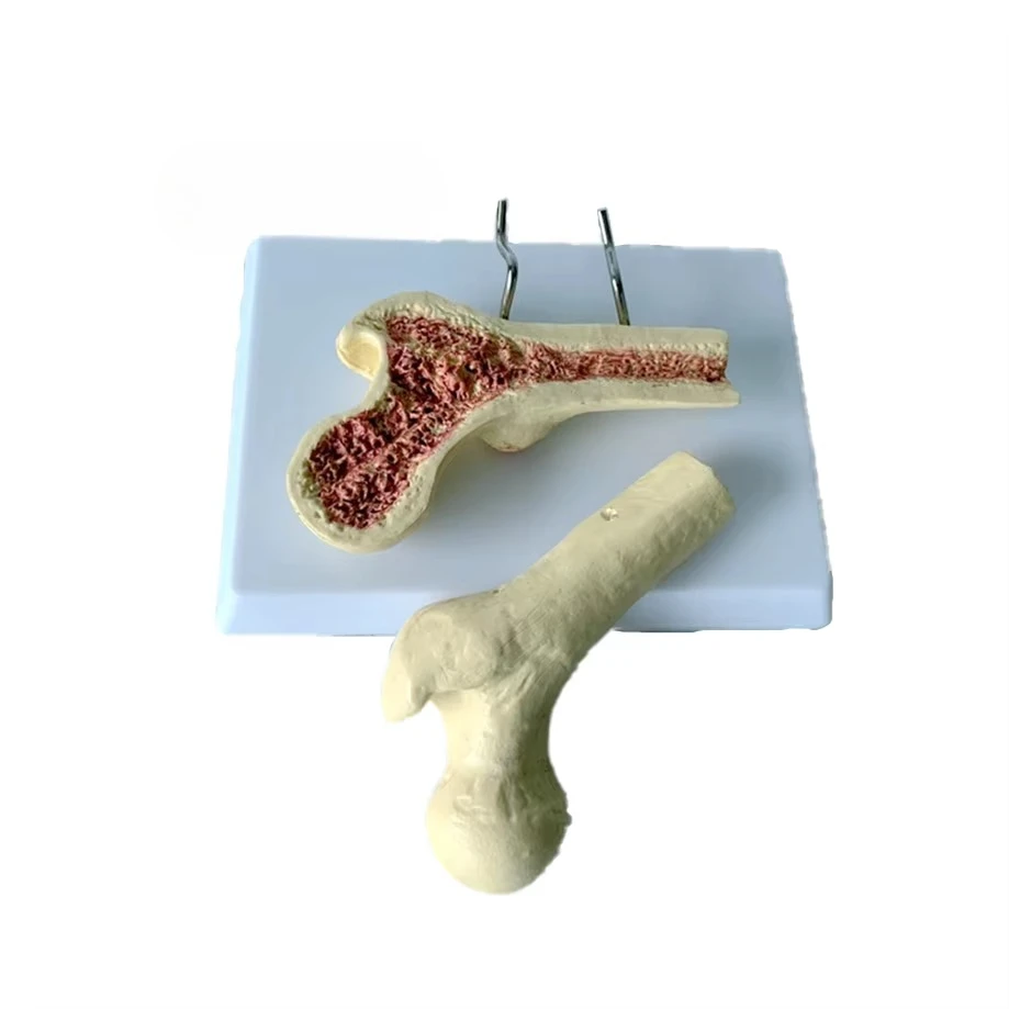 

Медицинская анатомия костора человека. Модель внутренней структуры. Остеопороз. Иллюстрации. Улучшенная считывамость скелета.