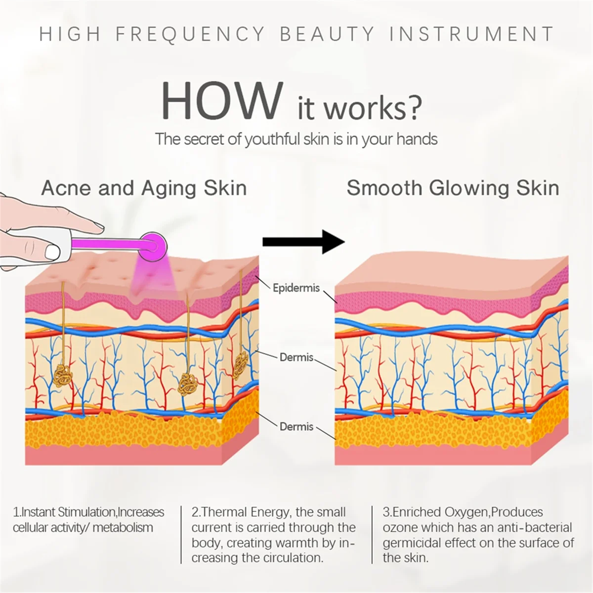 A14G-4 en 1 Portable haute fréquence électrothérapie dispositif de beauté dissolvant de taches soins de la peau Spa Derma 4 Violet prise ue