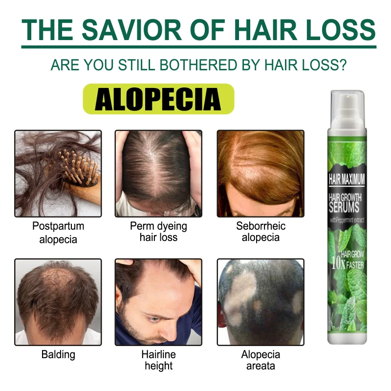 Hair Growth Serum Spray Anti Hair Loss Fast Hair Growth Regrowth Hair Prevention Hair Thinning