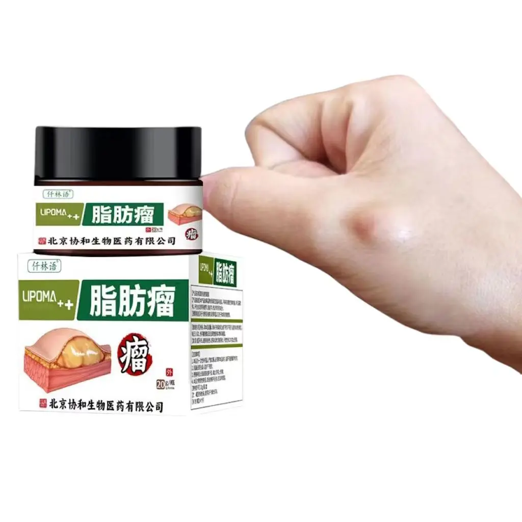 

Free shipping 20g to remove the whole body subcutaneous lipoma, cyst tumor removal cream to eliminate hard lumps