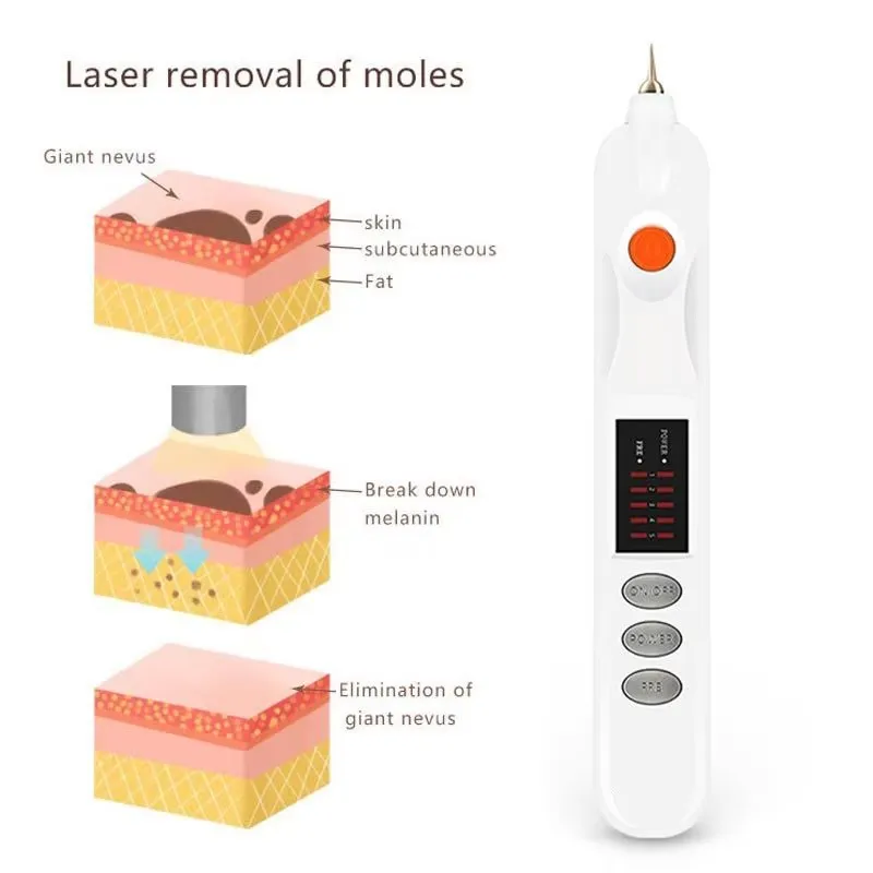 Wrinkles Freckles Mole Removal Ionic Spot Pen Body Skin Spots Facial Tattoo Removal Mole Removal Beauty Treatment Skin Pen view 3