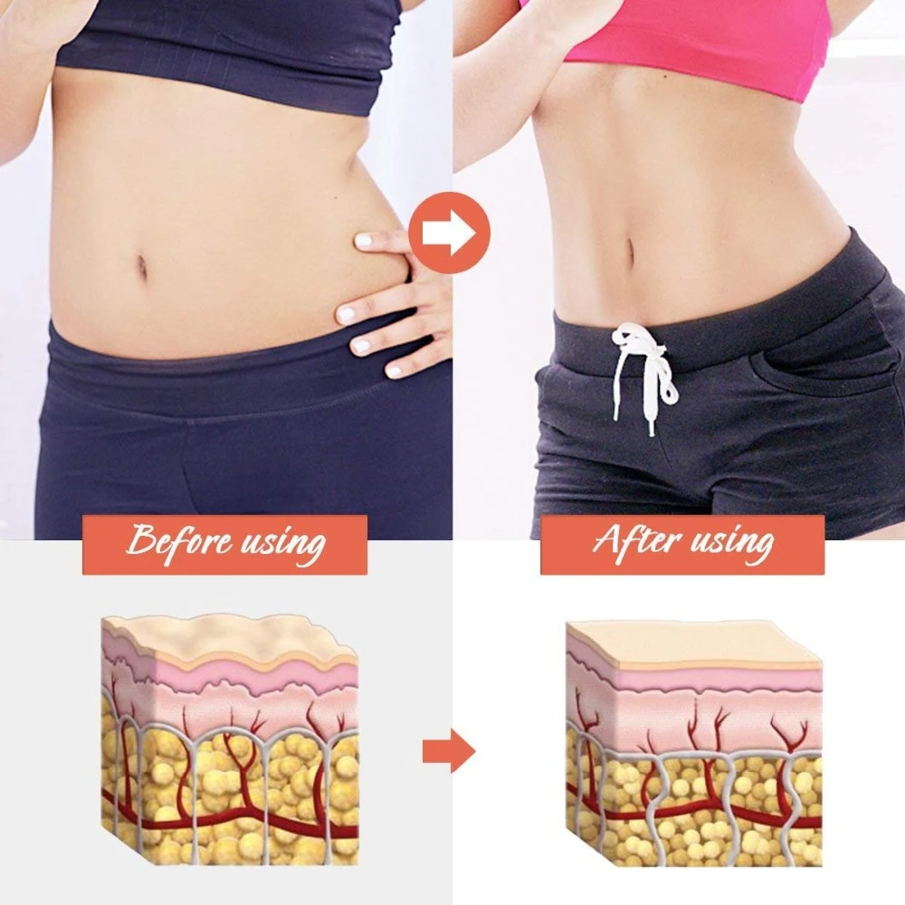 Tcare 5/10 قطعة البطن أكياس للتخسيس البطن التخسيس حرق الدهون السرة عصا فقدان الوزن أنحل أداة عجب الساخن سريعة التخسيس التصحيح