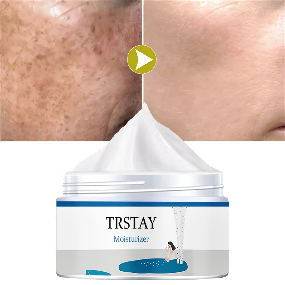 

TRSTAY Увлажняющий крем для отбеливания пятен, восстановления, антивозрастной уход за кожей лица для мам и детей