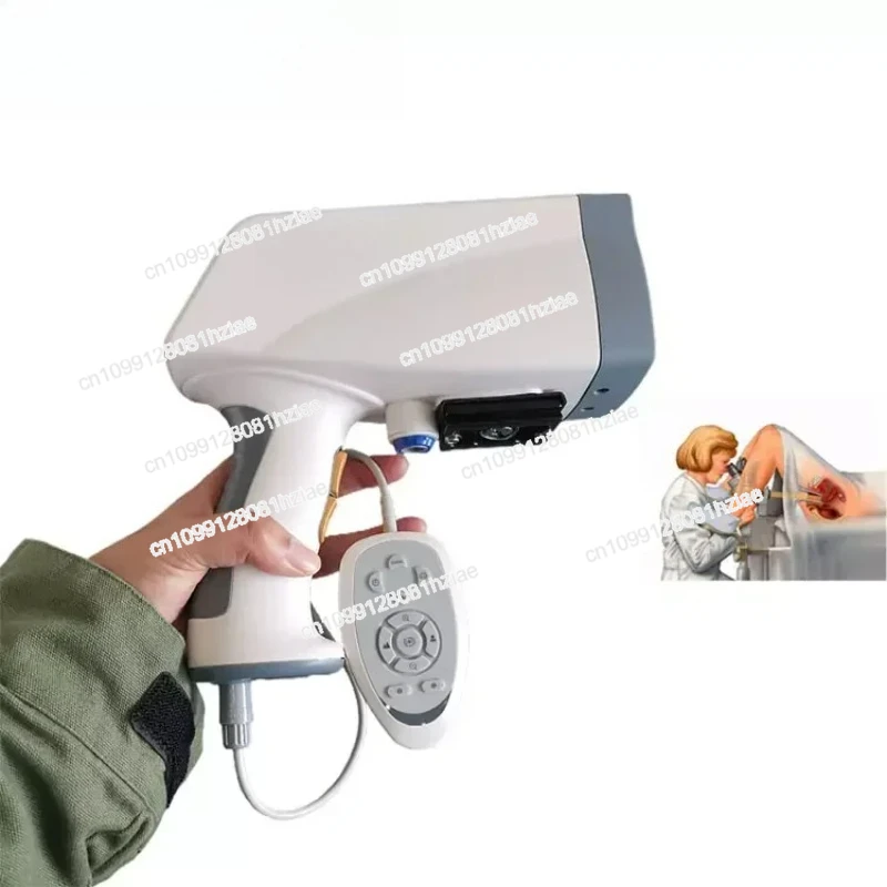 

Цифровая система изображения кольпоскопа CE 2200, кольпоскоп для осмотра влагалища для гинекологического колпоскопа