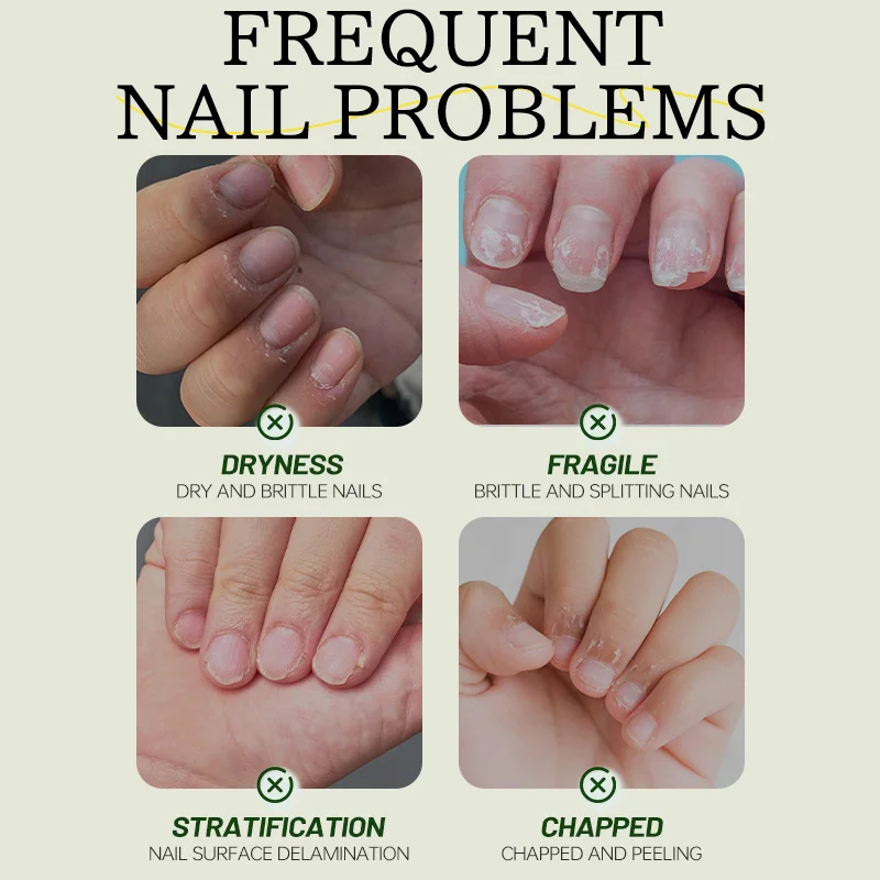 7 Days Nail Care Oil Keratin A - đánh giá và giá Nail Art Glossy