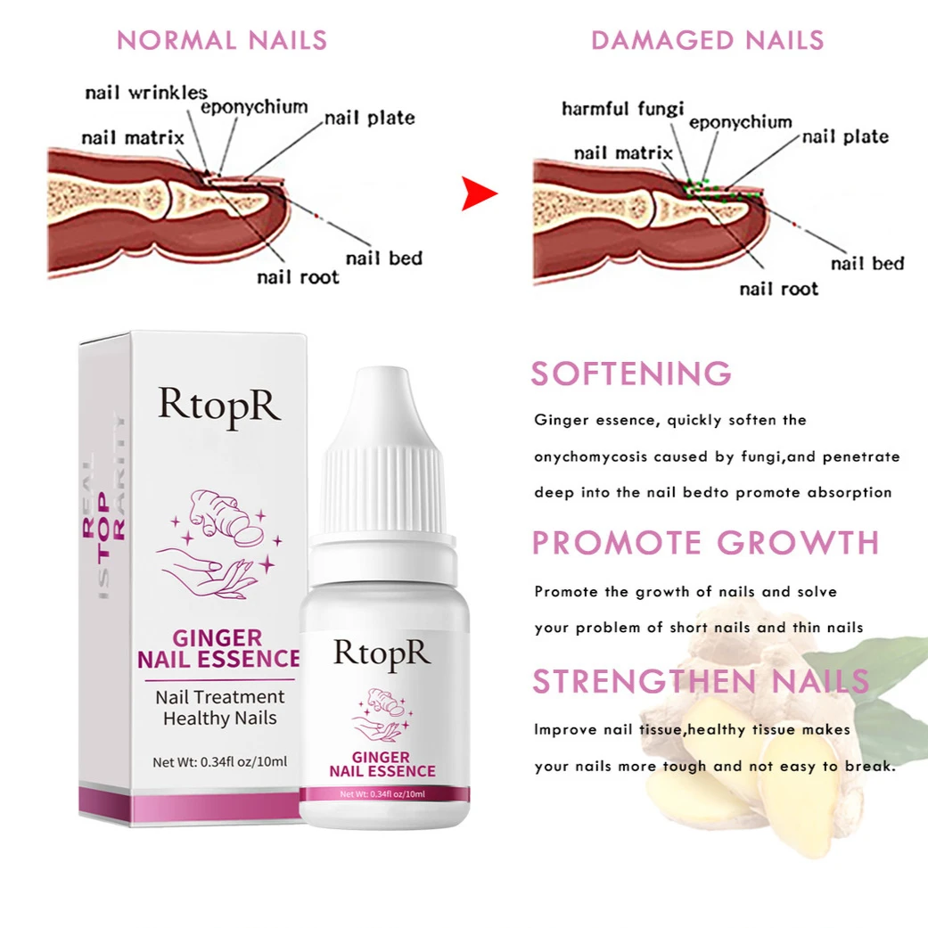 10ml Ginger Nail Essence nutriente unghie ruvide Anti Paronychia addensare Crack Nail Repair siero per il trattamento delle infezioni dell'unghia del piede