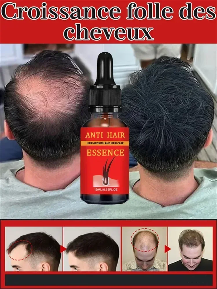 99% of buyers buy again, have more and more hair, say goodbye to baldness, thick hair,Hot selling product XXS