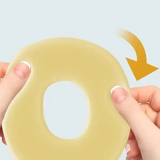 

1PCS Colostomy Bag Anti Leak-Proof Ring Plastic Patch Ring Stoma Base Leak-Proof Patch Ring Adhesive Glue
