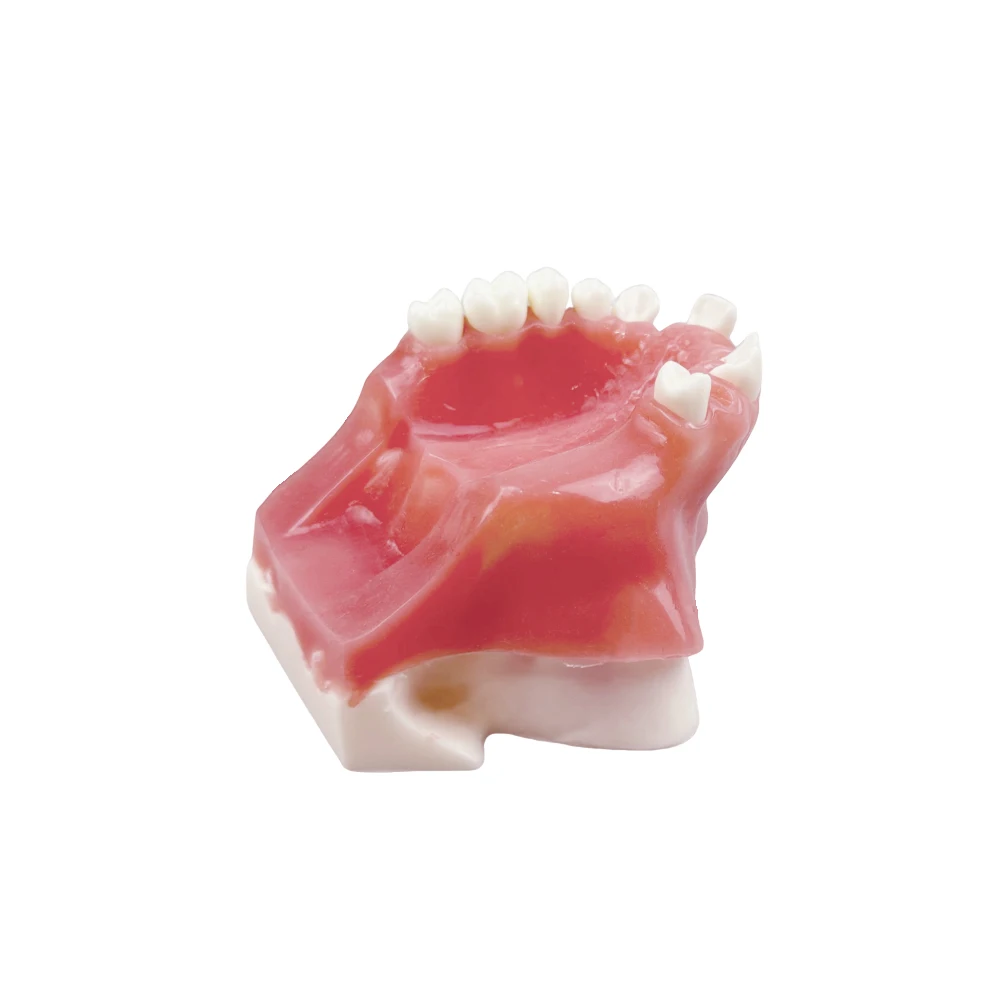 Maxillary Sinus Teeth Model Dental Implant Student Teaching Practice Model with Soft Gums Basic Implant Training Model Tools