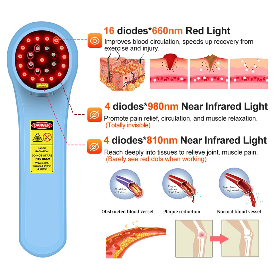 ZJZK 980nmx4 810nmx4 660nmx16 Therapeutic Laser for inflammation Medical Grade Laser Light Therapy for Deep Tissue Healing Human