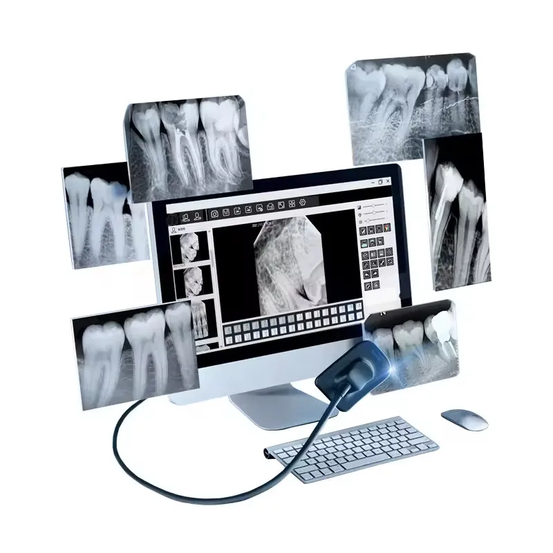 Intraoral X-ray Sensor R1/ R2 Intraoral Digital Imaging System USB RVG Imaging Sensor for Dentist Clinic