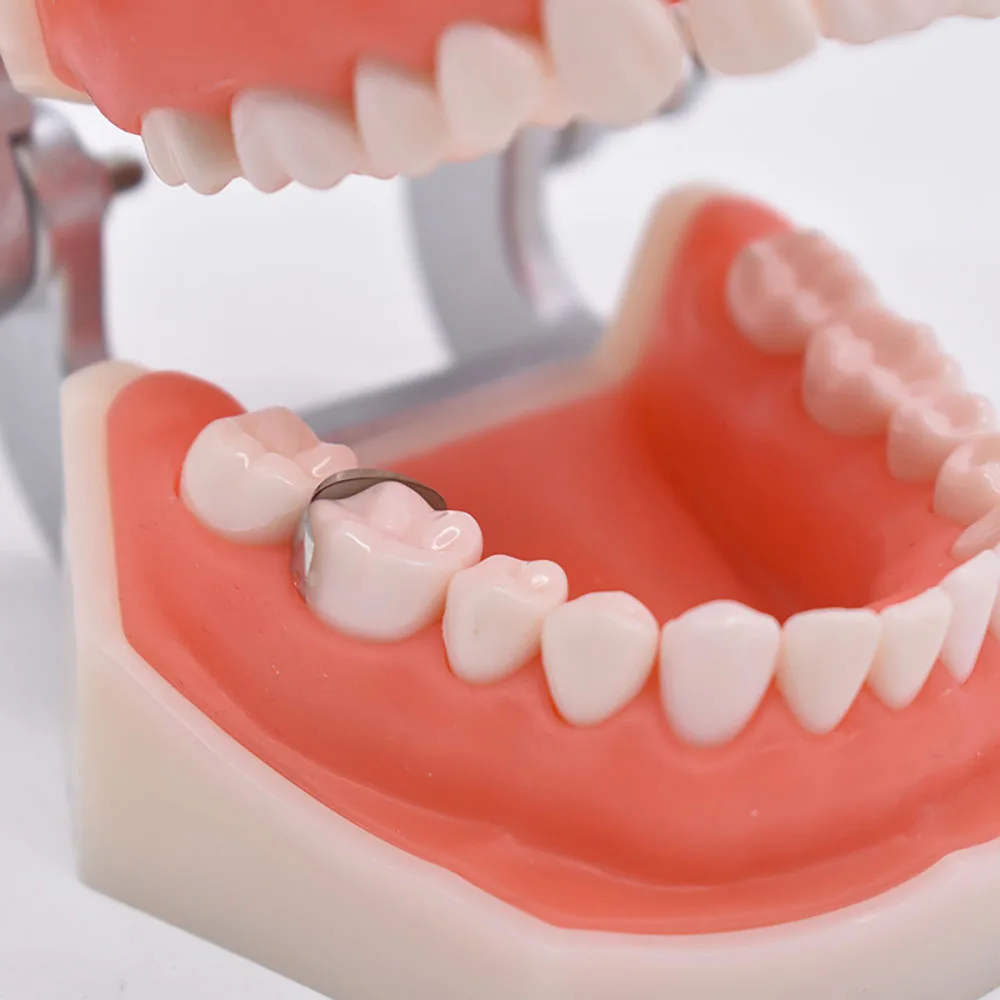 PIORPOY Dental Matrix Band Ring Sectional Matrice Clamp M4 NITI Sectional Contoured Bands Fit Palodent V3 Dentistry Material