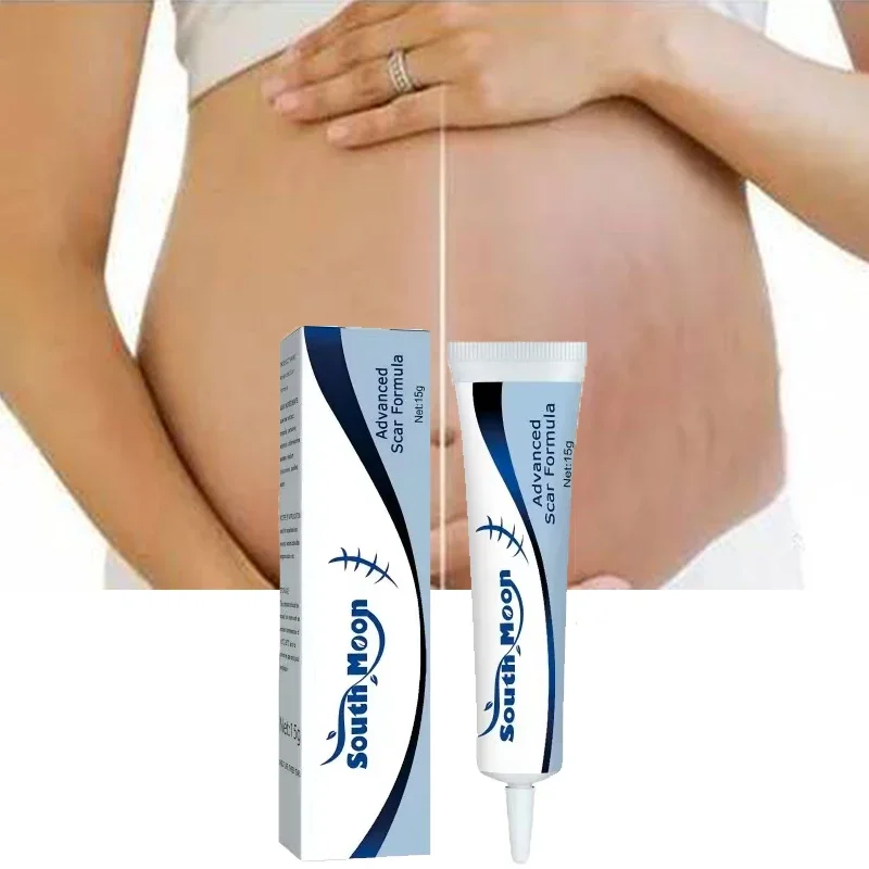 

Pregnancy repair cream, eliminates postpartum wrinkles, lightens growth lines and obesity, repairs wrinkles and stretches