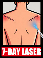 Scar disappearance is not a dream