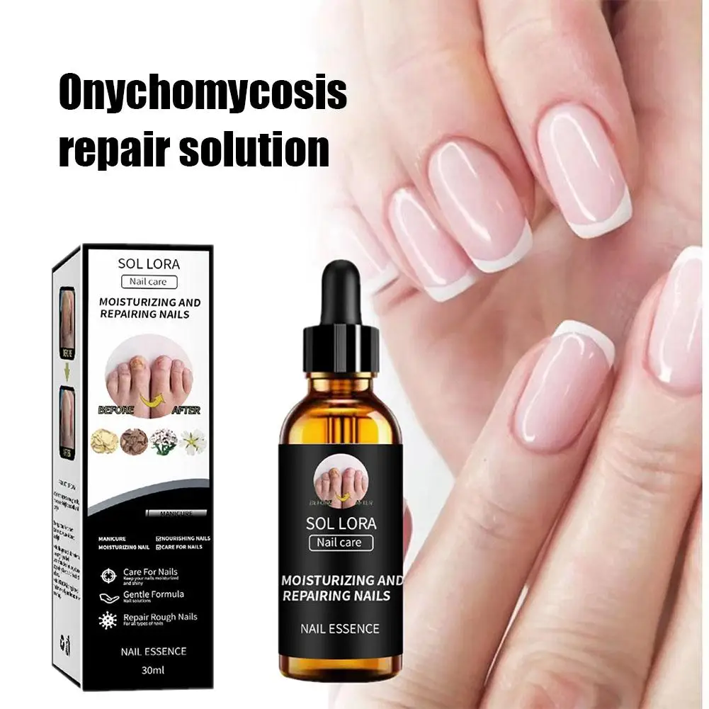 

Nail Fungus Treatment Serum Care Hand and Foot Care Ginger Care Removal Solution Repair Gel Anti-infective Nail Onychomycos D4S1