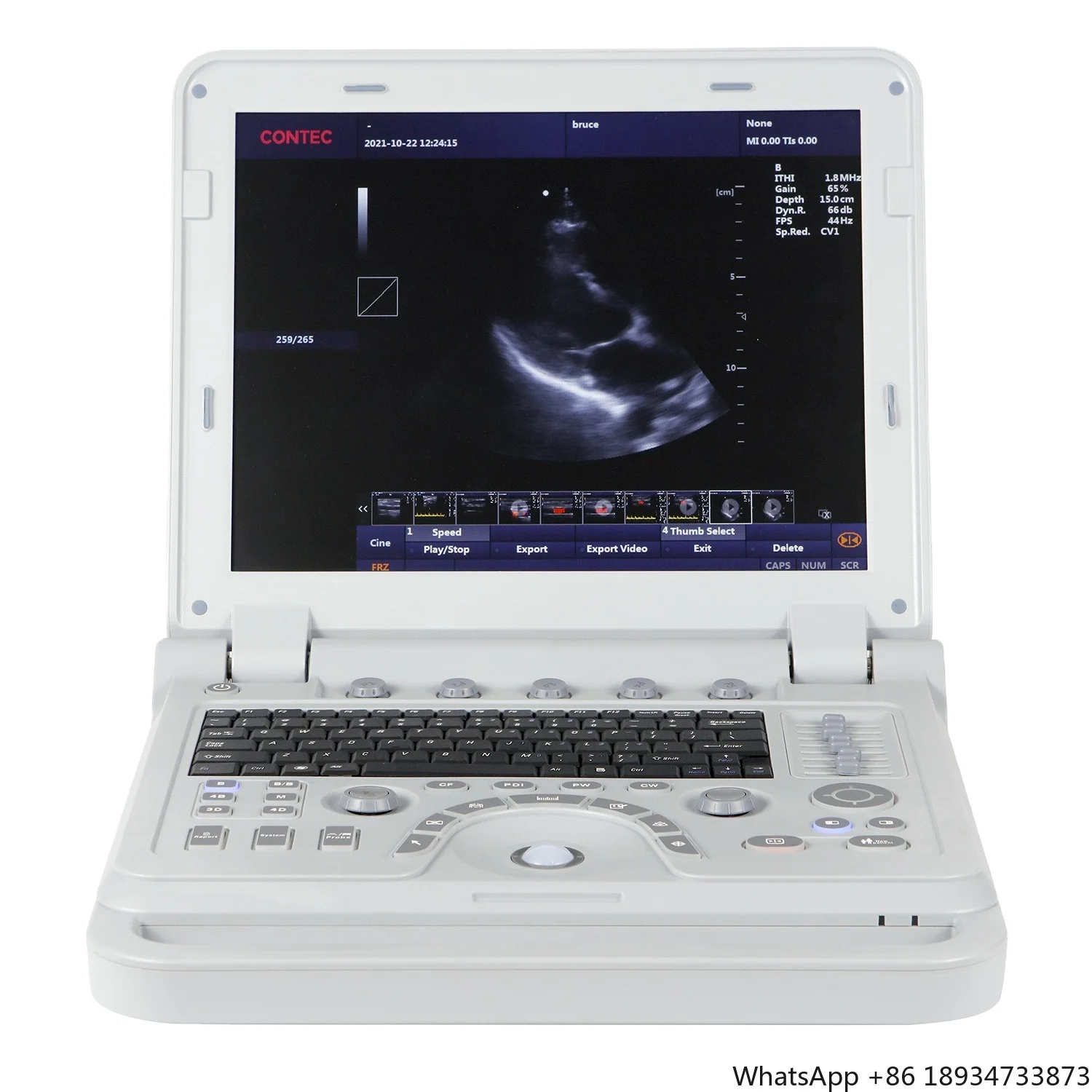 CMS1700B color doppler 3D 4D ultrasonic hospital portable diagnostic scanner ultrasound